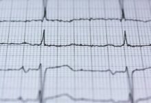 neural pulse technology device